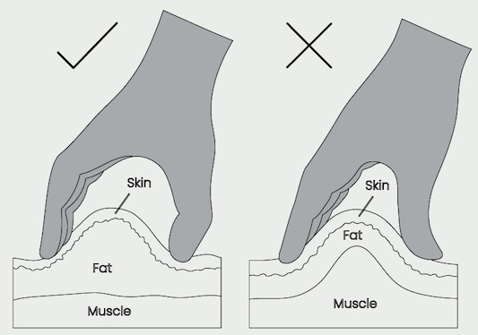 Illustration showing the correct and incorrect way to pinch skin for a subcutaneous testosterone injection; the correct method lifts only skin and fat, while the incorrect method includes muscle.