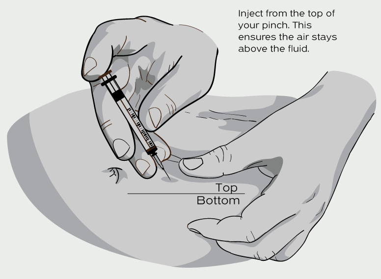 Illustration showing a subcutaneous injection into pinched abdominal skin, with syringe angled from the top to ensure air stays above the fluid during injection.