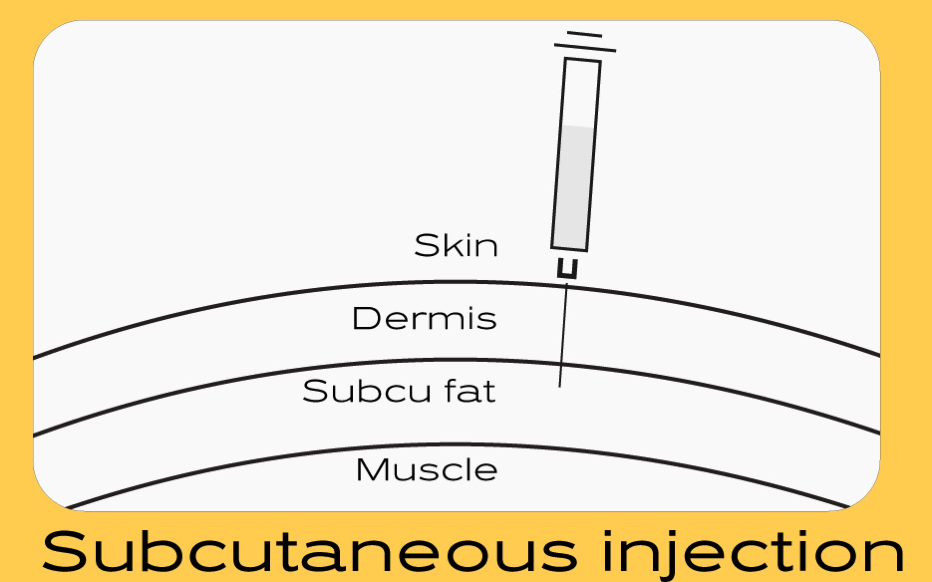 Diagram showing a subcutaneous injection with a syringe penetrating the skin layers: skin, dermis, subcutaneous fat, and muscle. The needle is shown delivering medication into the subcutaneous fat layer.
