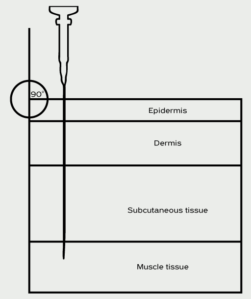Cross-section showing a needle entering at a 90-degree angle through the epidermis, dermis, subcutaneous tissue, and into the muscle tissue for intramuscular injection.