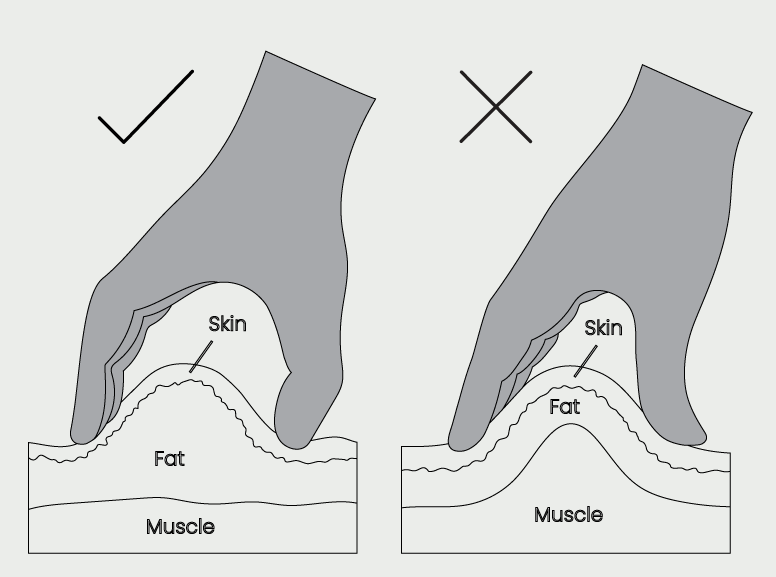 Diagram showing the correct and incorrect way to pinch the skin for a subcutaneous injection. Left: Proper technique—skin and fat are pinched away from the muscle. Right: Incorrect technique—muscle is lifted along with skin and fat.