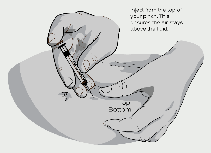 Illustration of a person performing a subcutaneous injection into the abdomen. The syringe is inserted at the top of a skin pinch, ensuring the air bubble remains above the fluid.